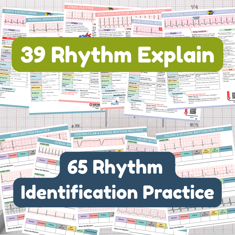Complete ECG Interpretation Study Guide with 100+ Practice Test and Rhythm Identification with Answers | Digital Download - NurseCheungStore