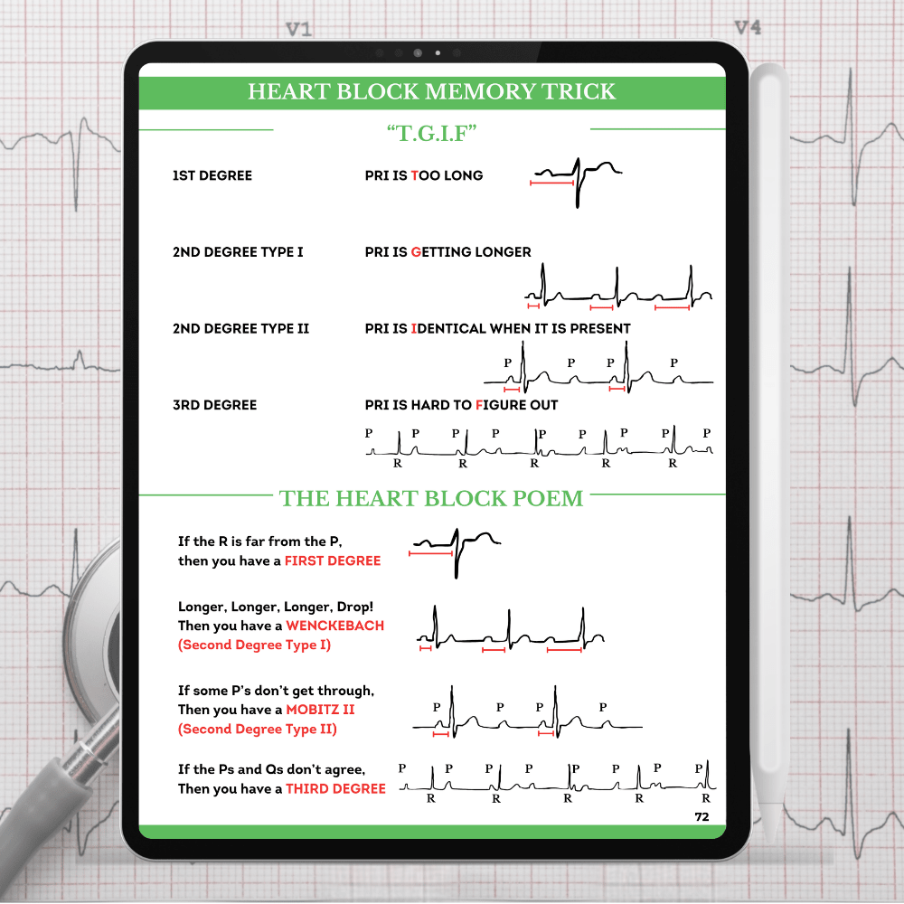 EKG & Dysrhythmia Interpretation Guide (Digital PDF) - NurseCheungStore