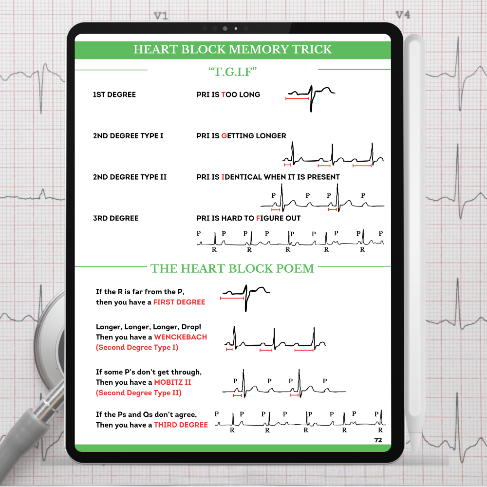 TGIF Heart Block Memory Trick and Poem for identifying First Degree, Wenckebach, Mobitz II, and Third Degree blocks.