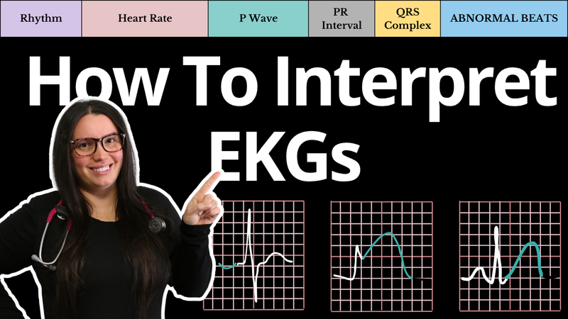 EKG Comprehensive Study Guide